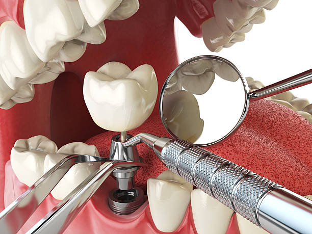 Best Emergency Dental Services Near Me  in Kenvil, NJ
